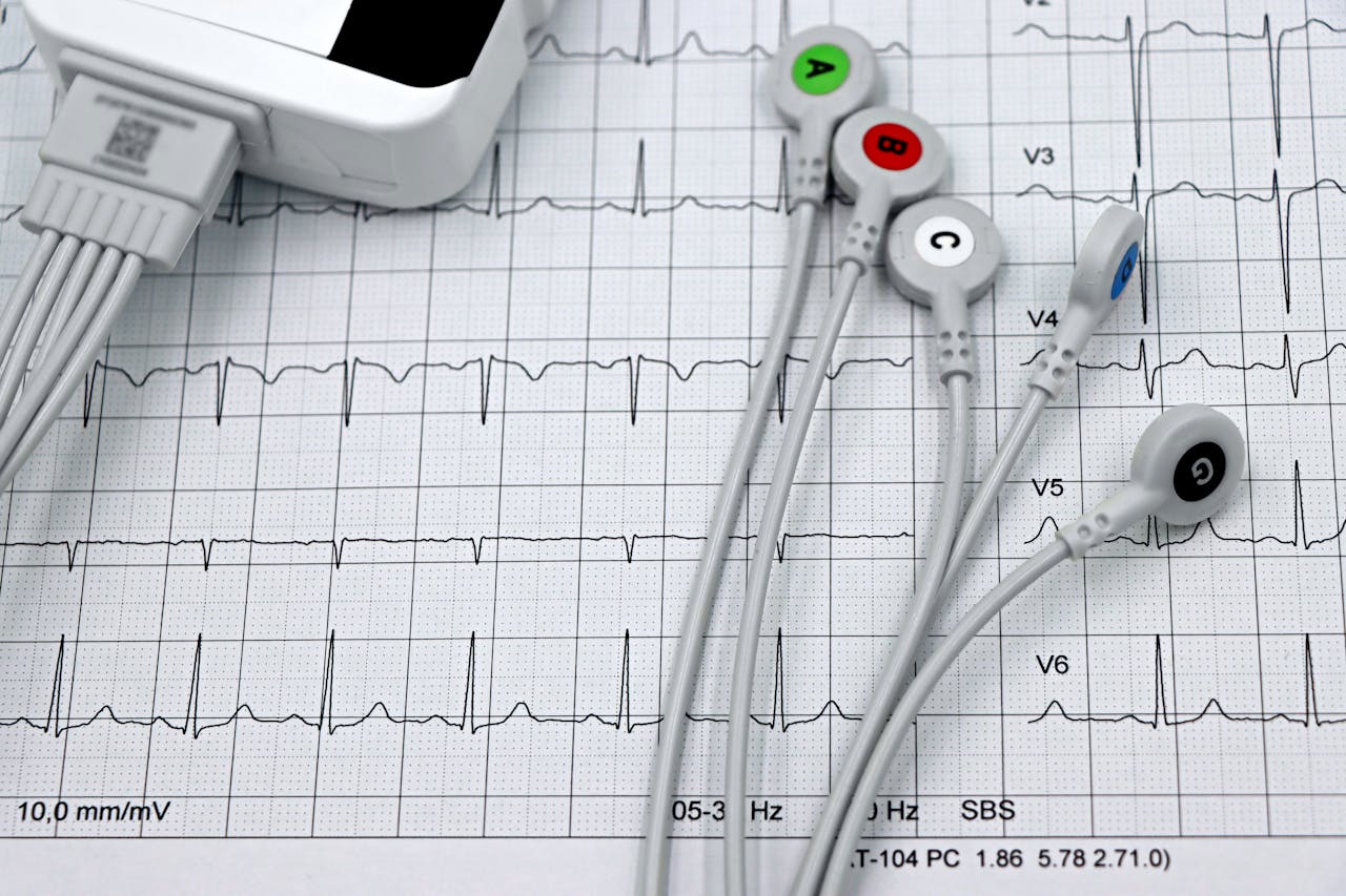 Close-up of ECG monitor leads on a printed cardiogram, showcasing heart health diagnostics.