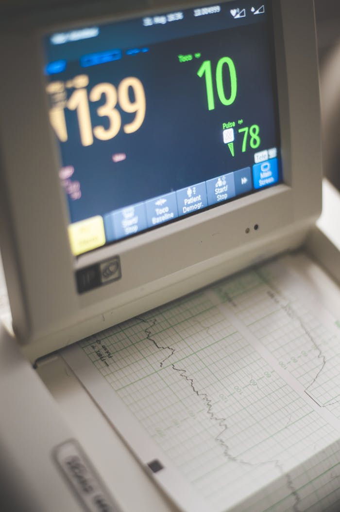 Close-up of an ECG monitor displaying heart rate and pulse data in a medical setting.